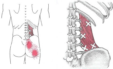 Photograph accompanying QL Care: Look after this Troublesome Cycling Muscle to Avoid Lower Back Pain